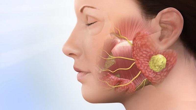 Hình ảnh minh họa cận cảnh khuôn mặt chú chó với biểu hiện chảy nước bọt và sùi bọt mép, một trong những dấu hiệu điển hình của bệnh dại ở giai đoạn cuối